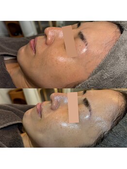 ビエン(美艶 b.en)/１回で印象ががらりと変わる♪