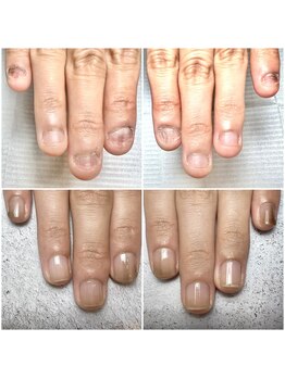 最強のネイルケアコース