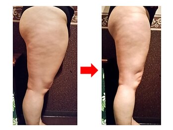 ファウンデーション(FOUNDATION)/ボディハイパーナイフ