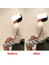 ナオル整体 福岡香椎院(NAORU整体)/30代男性施術事例【頸部可動域】