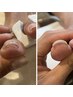New【巻き爪矯正】巻き爪ケアができるジェルネイル(10本フルコース)