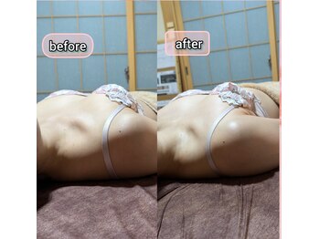 スノードロップ(snowdrop)/バストアップ　20代の方