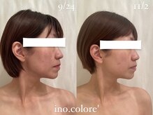 リノコロレ(ino.colore')/【ブライダルコルギ】×7回