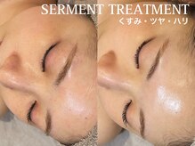 クレスト(CLEST.)/艶玉セルマントリートメント