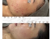 ベベ 表参道(bebe)/1年間通っているお客様の症例