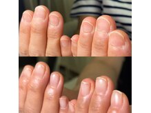 ニューネイル(NEW☆NAIL)の雰囲気（実は伸び代だらけだった！）