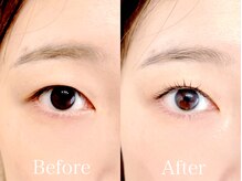 エルフ(elf)/【パリジェンヌ】Before→Afte