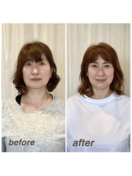 ウォーブ(Wobe)/見た目年齢も変化☆