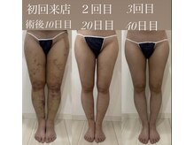 ダウンタイムオンニ(DowntimeOnni)