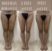 ダウンタイムオンニ(DowntimeOnni)