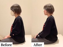 ソレア(Solea)/首こり・肩こり改善1回目