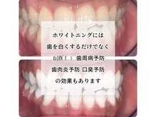 スタイリッシュビューティー(stylish beauty)/歯科医提携セルフホワイトニング