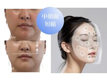 ニュイブラーシュ(nuit blanche)の雰囲気（史上最強のリフトアップ！同時に美肌も叶える次世代エステ）