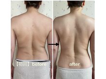 ラレコルト/ビフォーアフター