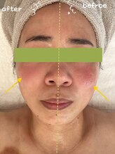 ミューズ 成城(MUSE)/シミ・くすみ・赤み・かんぱん