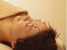 眼精疲労に効くお目元のお灸が人気♪デスクワークの方にオススメ