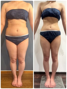 アミナス(Total Beauty Salon AMINAS)/ダイエットならお任せ♪