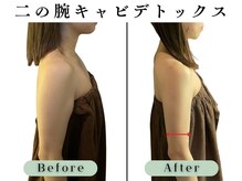 ブライダルエステ バイ スイスパ表参道(BRIDAL ESTHE by SUI SPA)