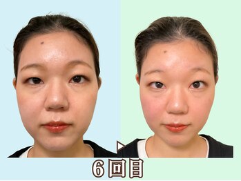 ナチュラルビューティーフェイス 横浜(NBF)/お化粧も変わる小顔美