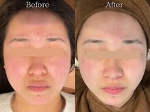 ライフサロン 天神(Life Salon)の雰囲気（韓国肌管理と言えば【Life Salon天神】！肌質改善/赤みケア）