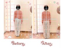 トータルボディケア 整体院ハルヨシ(Total Body Care)/姿勢改善