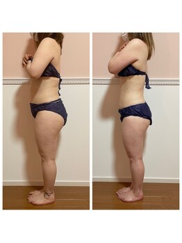 トータル フィルシャイン(Total Fillshine)/痩身モニター様☆★