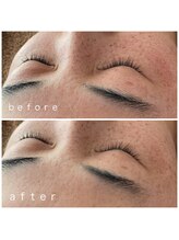 メナードフェイシャルサロン 岐阜茜部/ホワイトニングパック