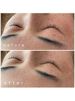 メナードフェイシャルサロン 岐阜茜部/ホワイトニングパック