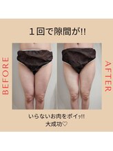 ココノワ(coconoix)/脂肪冷却&キャビテーション