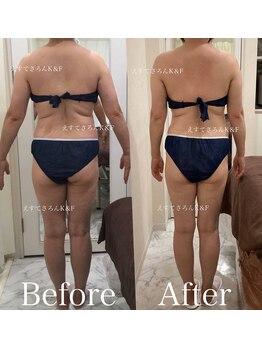 えすてさろん ケイアンドエフ(k&f)/飲みくすり手放し肩こり解消50代