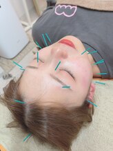 ヒーリングサロン アージュ(A-je)/★美顔鍼＋小顔矯正★