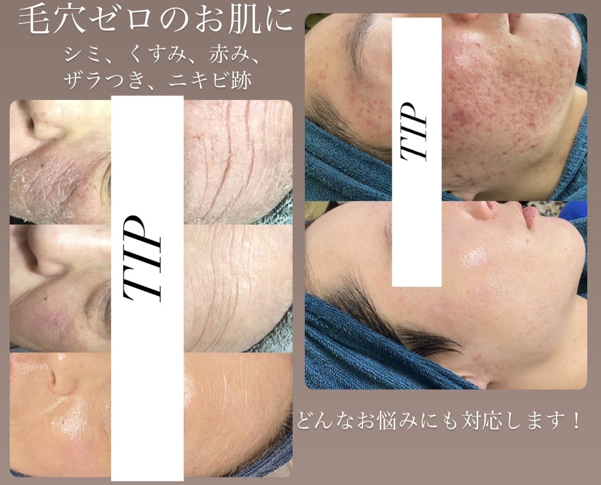 ペルボヌール｜ホットペッパービューティー