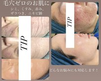 ペルボヌール