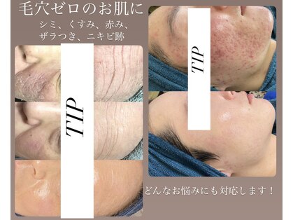 ペルボヌールの写真