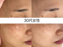 サクラ 本厚木駅前店(SAKURA)/本厚木シミケア/伊勢店シミケア