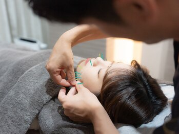 ヴィーライン 上大岡(VeLine)/形状記憶美容鍼のご説明