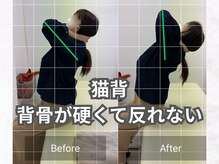 ナオル整体 仙台泉中央院(NAORU整体)/猫背・巻き肩の悩み