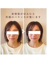 ルフレ(Reflet)/表情筋ケア