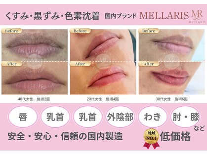 レガート(Legato)の写真