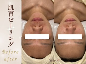 リボーン(Reborn)/【毛穴改善】キュッと引き締め