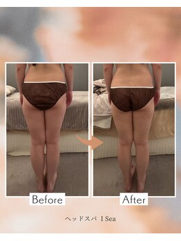 アイシー(I Sea)/バザルトボディ☆