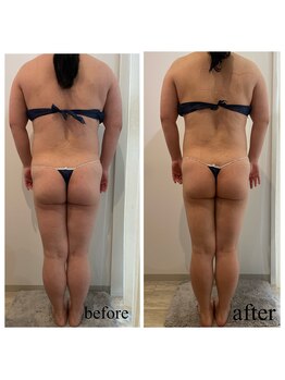 ドリームローズ(Dream Rose)/痩身