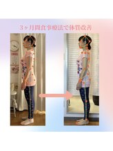 整体院 ツイてる(椎照)/姿勢改善・減量