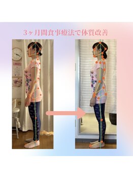 整体院 ツイてる(椎照)/姿勢改善・減量