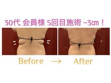 ルミーナ 高崎本店(Lumina)の雰囲気（たった数回でこの変化！！）