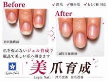 ラピスネイル(Lapis Nail)