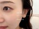 モーイ ブルップ 高槻店(mooi beloep)の写真