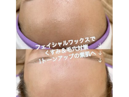 ノート(note)の写真