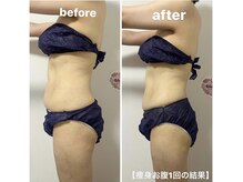 きれい塾 恵比寿/痩身【お腹】