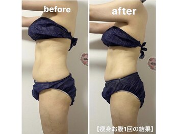 きれい塾 恵比寿/痩身【お腹】